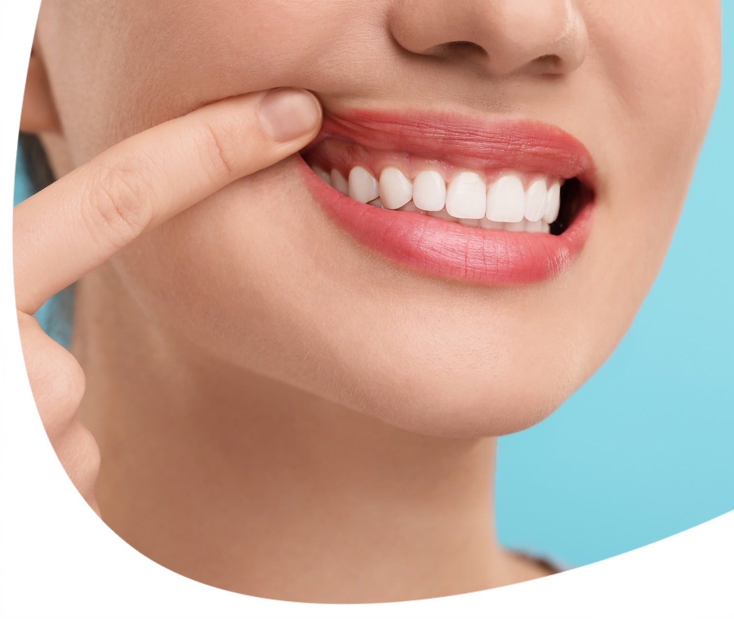 Fogínygyulladás: okok és következmények. Így előzd meg az ínybetegséget!